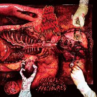 200 Stab Wounds - Manual Manic Procedures vinyl cover