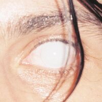 Armlock - Trust (Gray/Black) vinyl cover