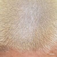 Barnt - Prometal Fan Decor Only vinyl cover