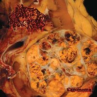 Blasted Pancreas - Carcinoma vinyl cover