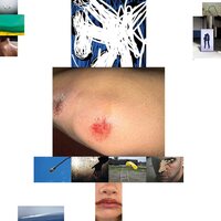 Remo Helfenstein - Spite vinyl cover